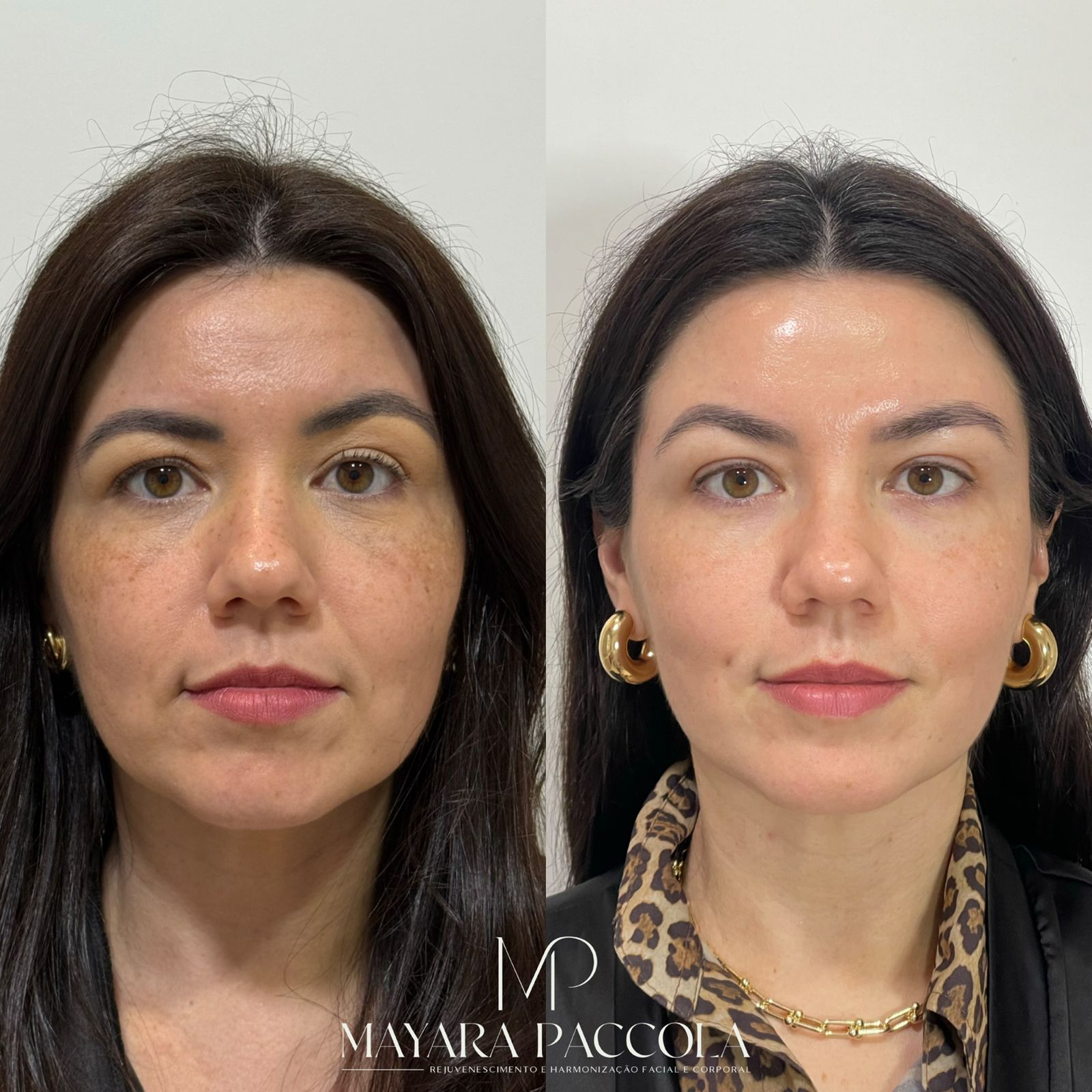 Antes e depois de paciente da clínica