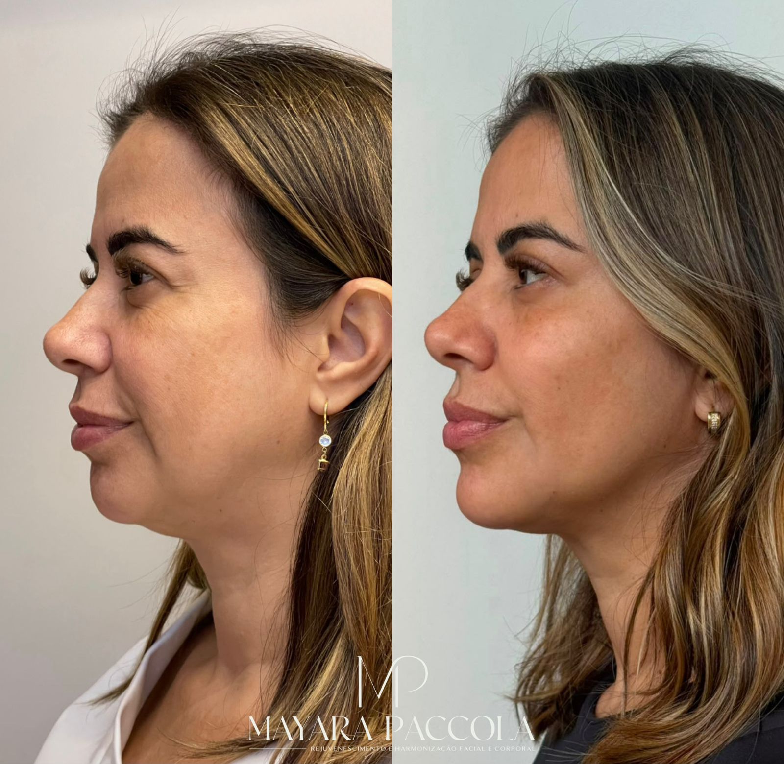 Antes e depois de paciente da clínica