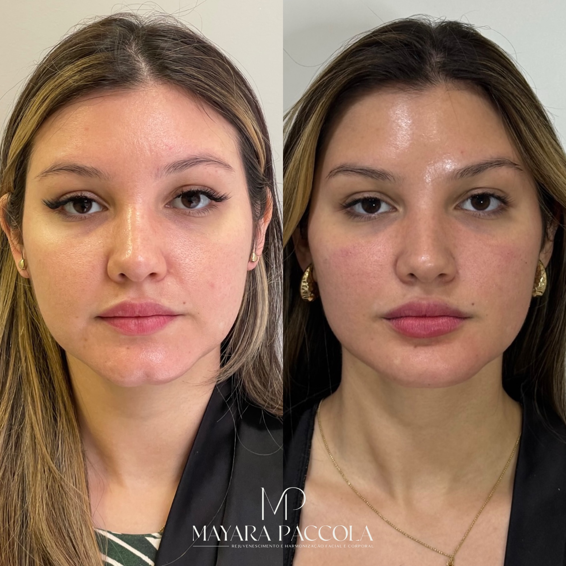 Antes e depois de paciente da clínica