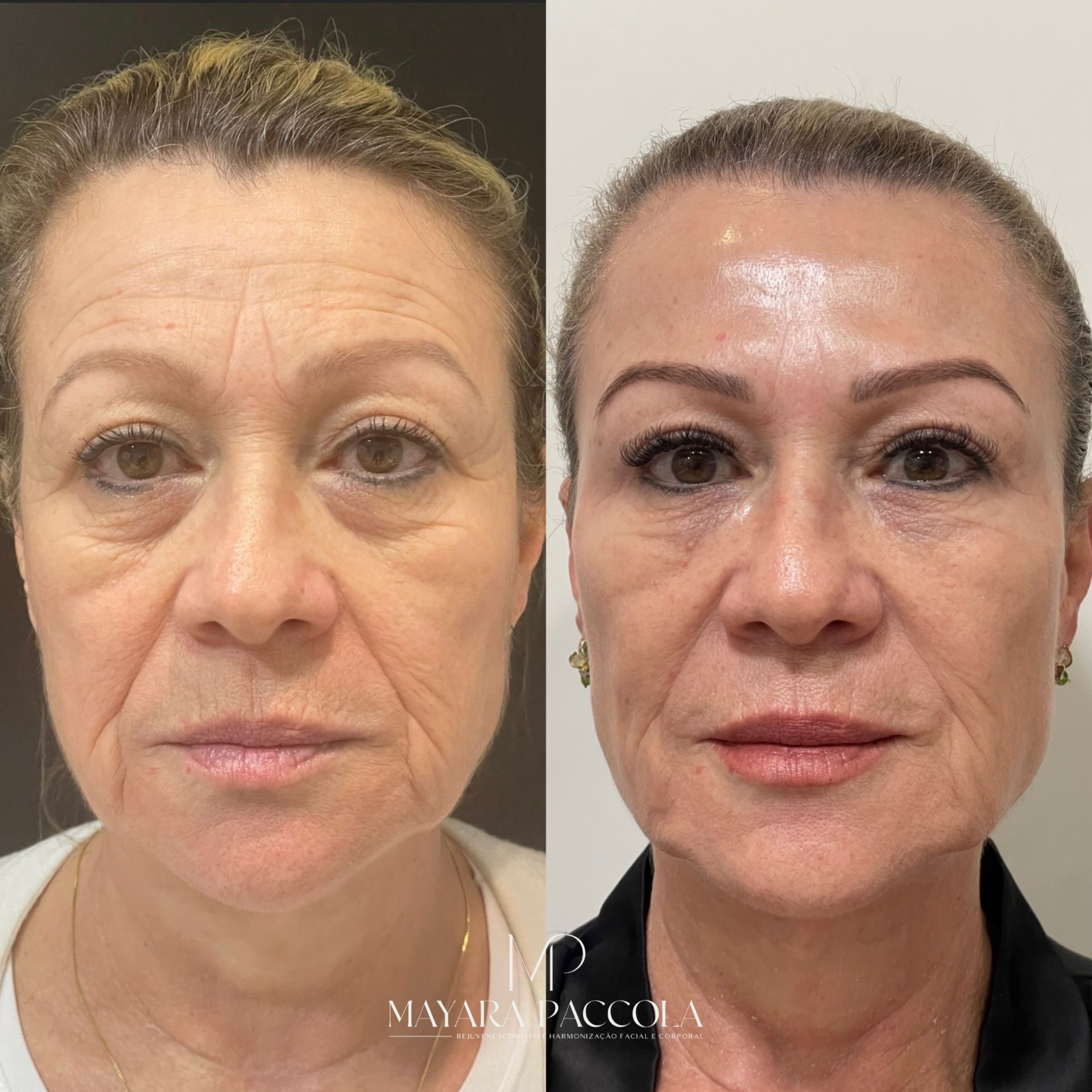 Antes e depois de paciente da clínica