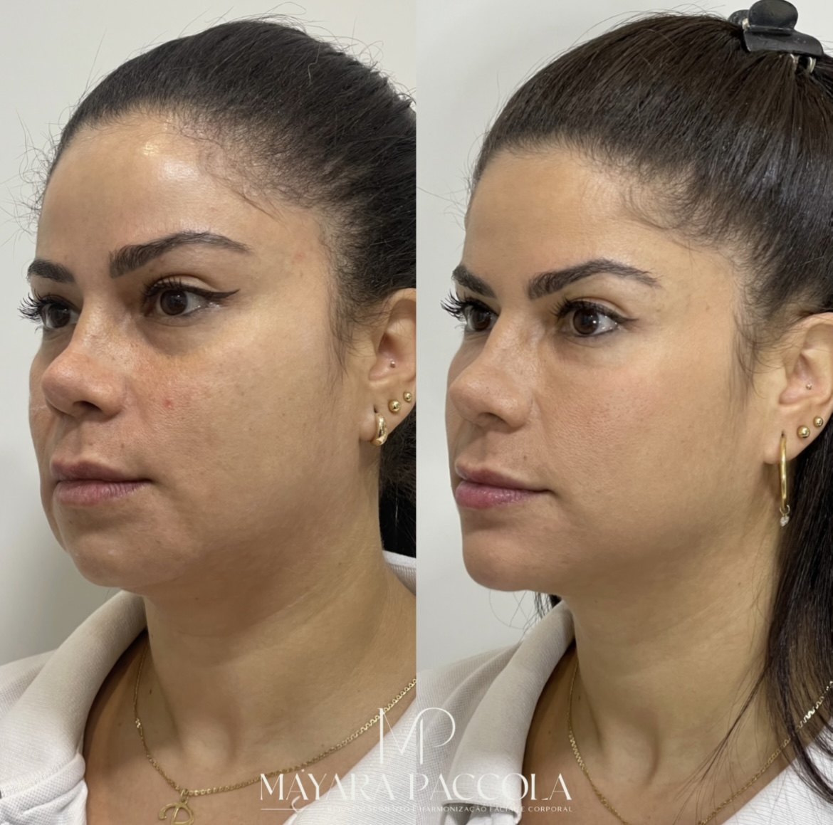 Antes e depois de paciente da clínica