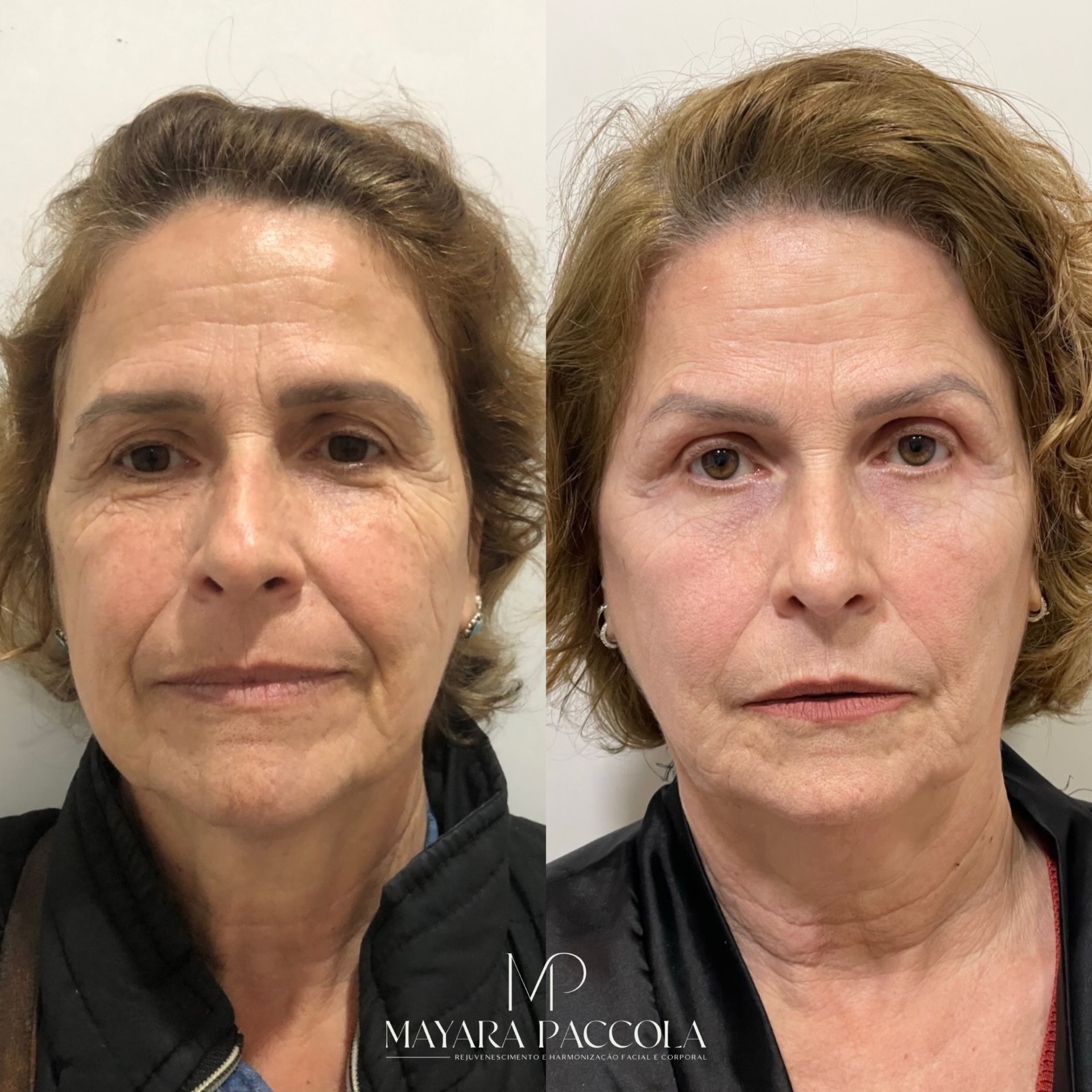 Antes e depois de paciente da clínica